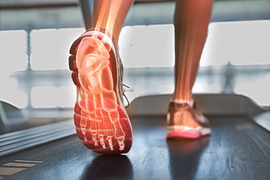 Running store with hot sale gait analysis